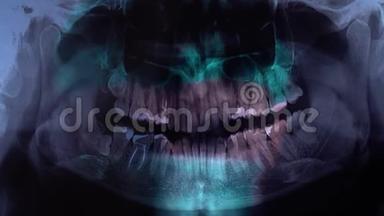 医生在x光片上显示牙齿。牙医一边看一边拿着x光片。牙医看牙特写